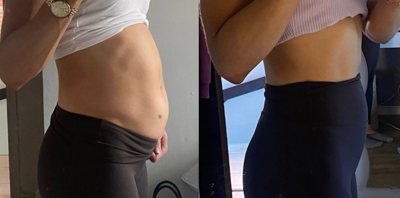 bloating-before-and-after-supplements