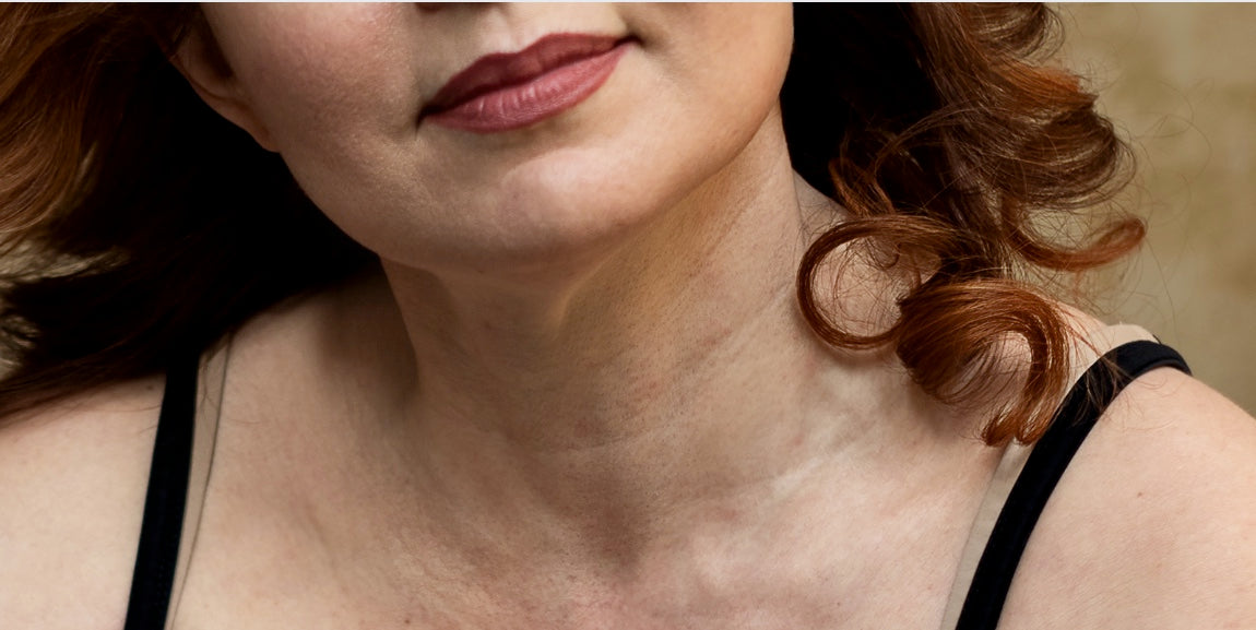 The most common skin issues women experience during menopause