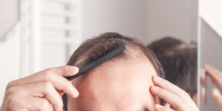 man suffering from hair loss combing his hair