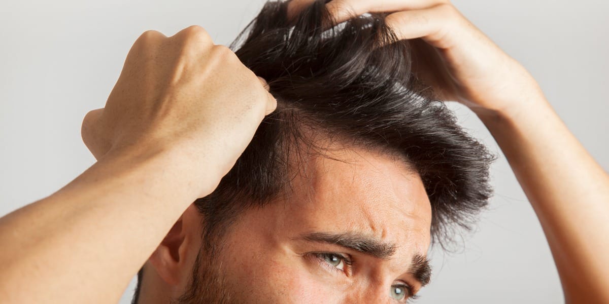 Young man suffering from hair loss due to stress